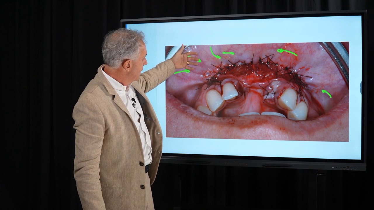 Dr. Paulo Pasquali apontando as marcações sobre o caso cirúrgico real durante a aula